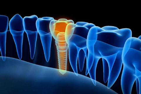 Dental Treatment