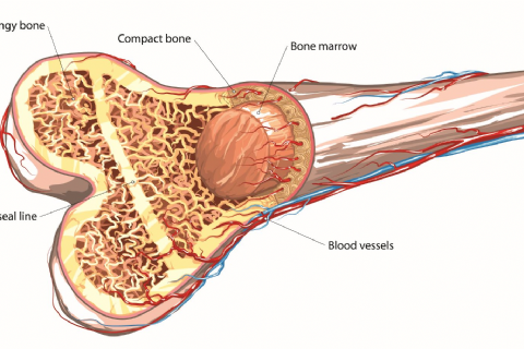 Bone Marrow Transplantation